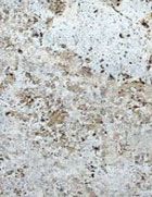 Burenbruch-Muschelkalk